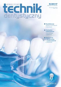 Nowoczesny Technik Dentystyczny wydanie nr 5/2017