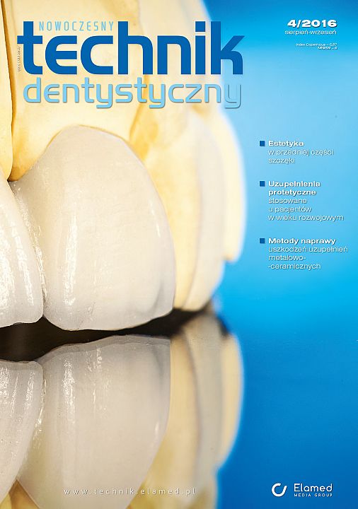 Nowoczesny Technik Dentystyczny wydanie nr 4/2016
