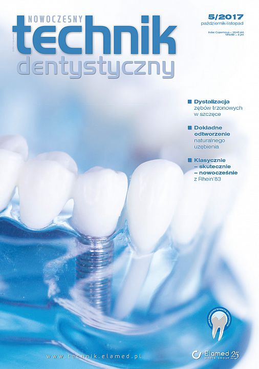 Nowoczesny Technik Dentystyczny wydanie nr 5/2017