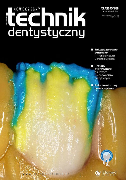 Nowoczesny Technik Dentystyczny wydanie nr 3/2018