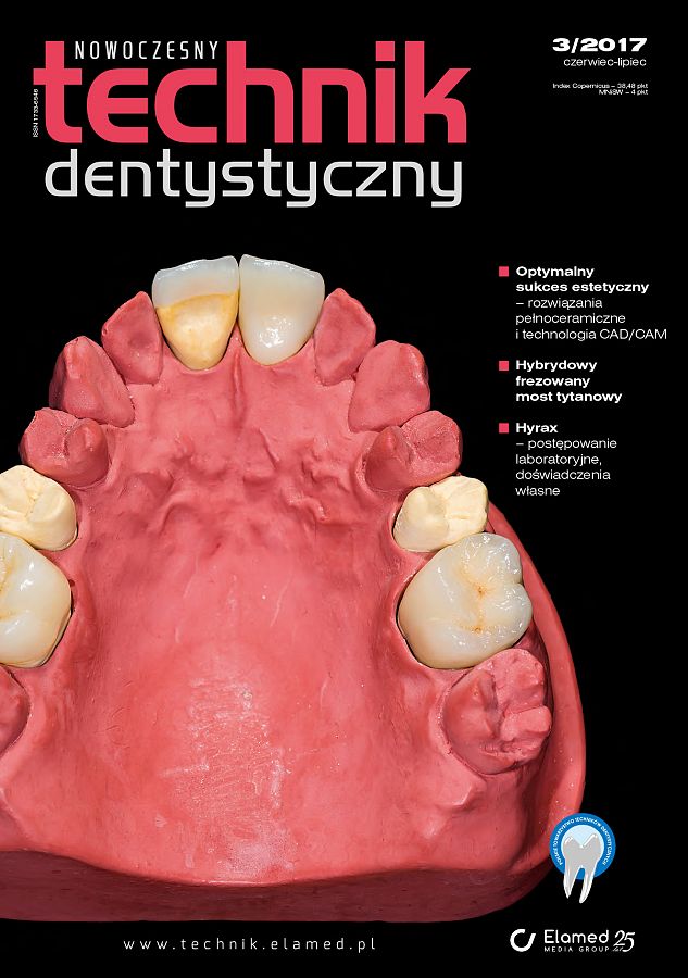 Nowoczesny Technik Dentystyczny wydanie nr 3/2017