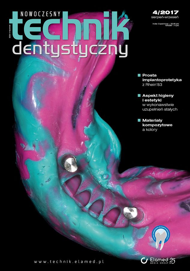 Nowoczesny Technik Dentystyczny wydanie nr 4/2017