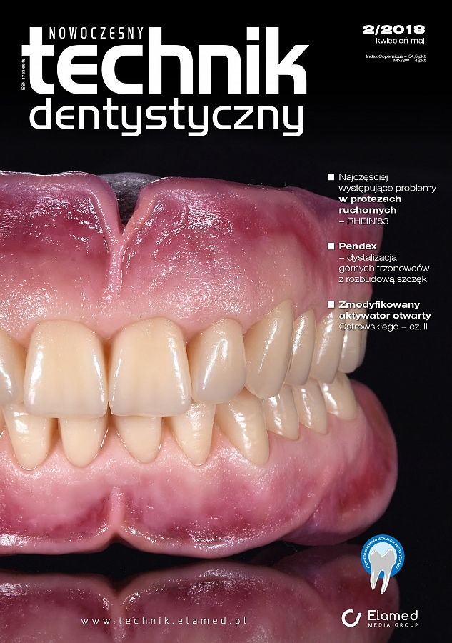 Nowoczesny Technik Dentystyczny wydanie nr 2/2018